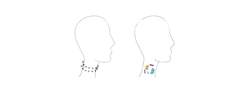 причины болезни горла