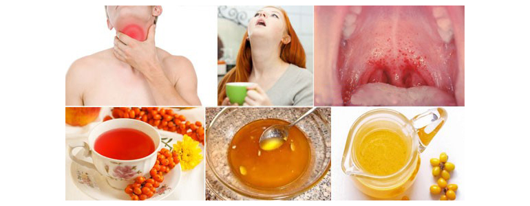 облепиховое масло