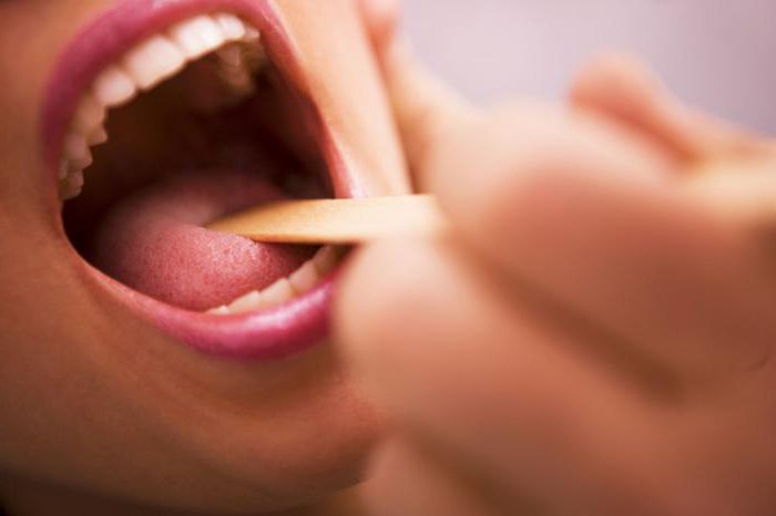 Как избежать боль в горле