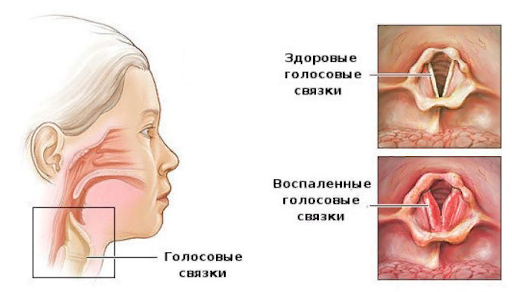 голосовые связки