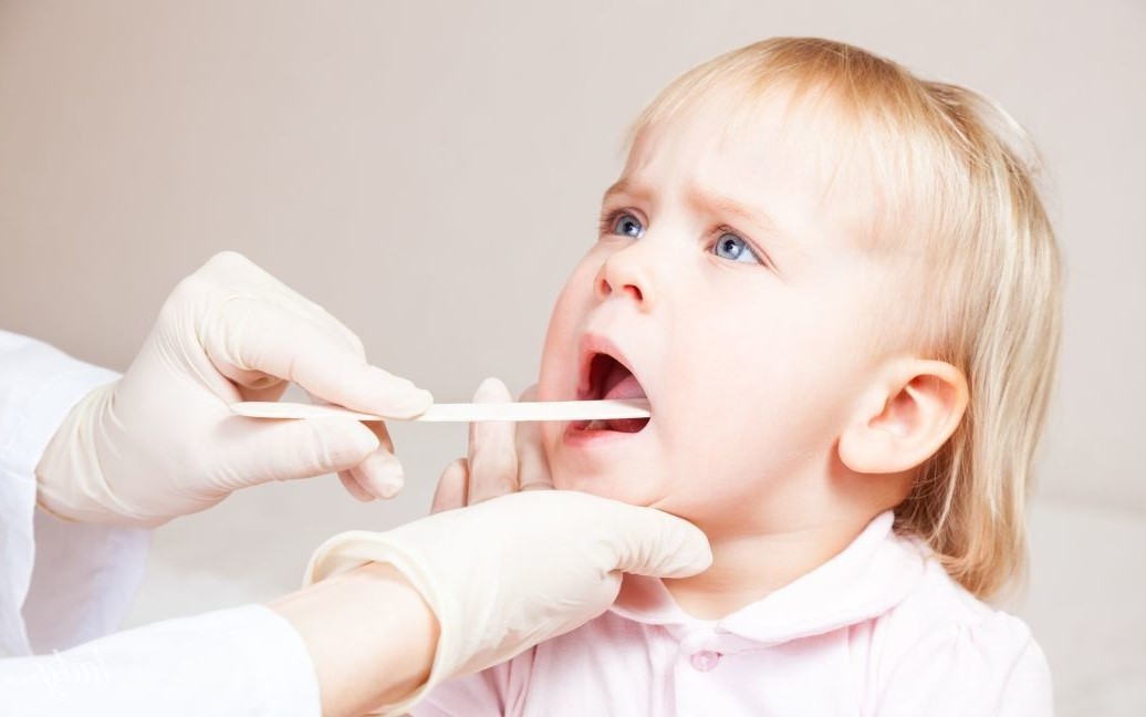 Фарингит у детей: причины, симптомы, диагностика