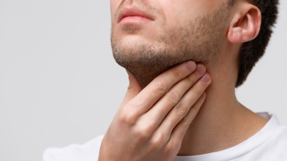 Острый фарингит